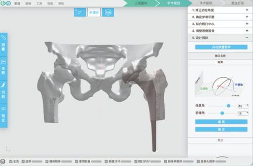 3d打印人体骨骼 这家哈佛大学孵化的公司要为中国医生开发自己的软件平台...